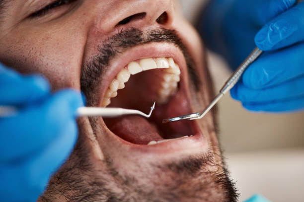 Best Broken or Cracked Tooth Emergency Dentist in Westfield, PA
